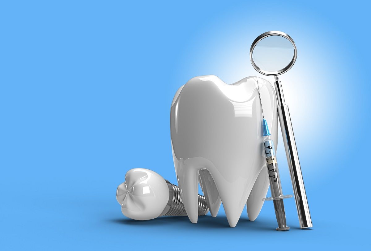Discover the Benefits of Dental Implants
