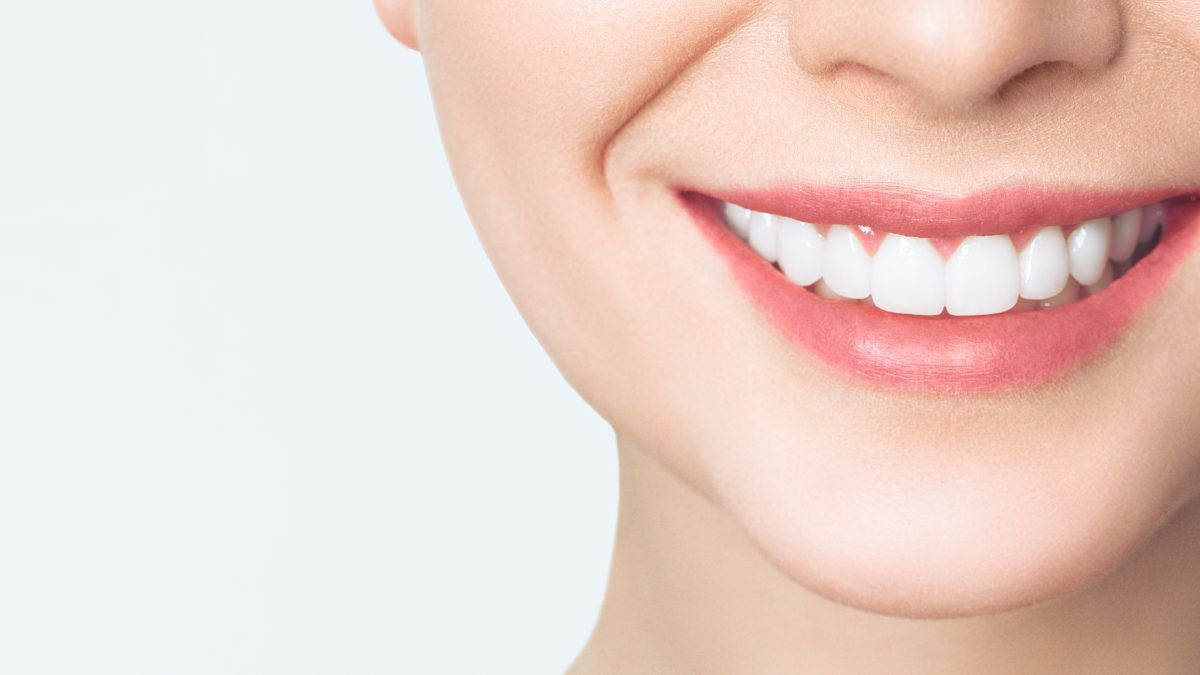 Why-Choose-Teeth-Whitening-1-1200x675.jpg