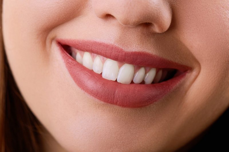 closeup-beautiful-young-woman-smile-dental-health-teeth-whitening-restoration-concept-copy.jpg